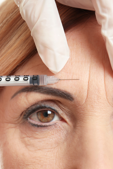 woman receiving neuromodulator injections in forehead